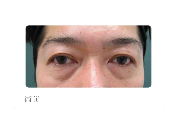 手術前の写真