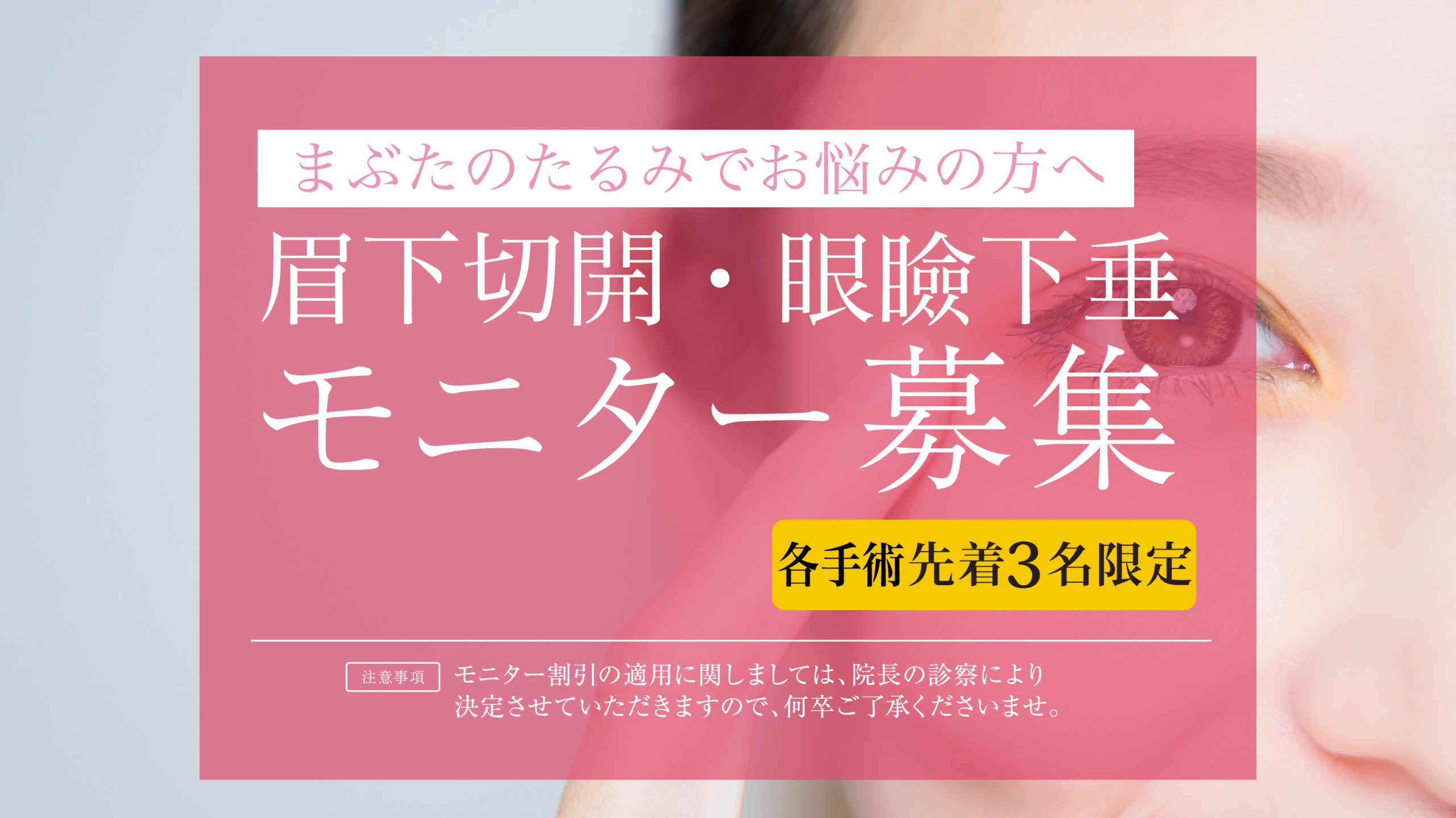 施術モニター募集。施術費用がお得な価格になる施術モニターを募集しております。